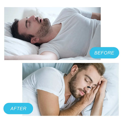 Before and after using Airoze magnetic nasal strips showing snoring relief and improved sleep quality (Sleep Aid)